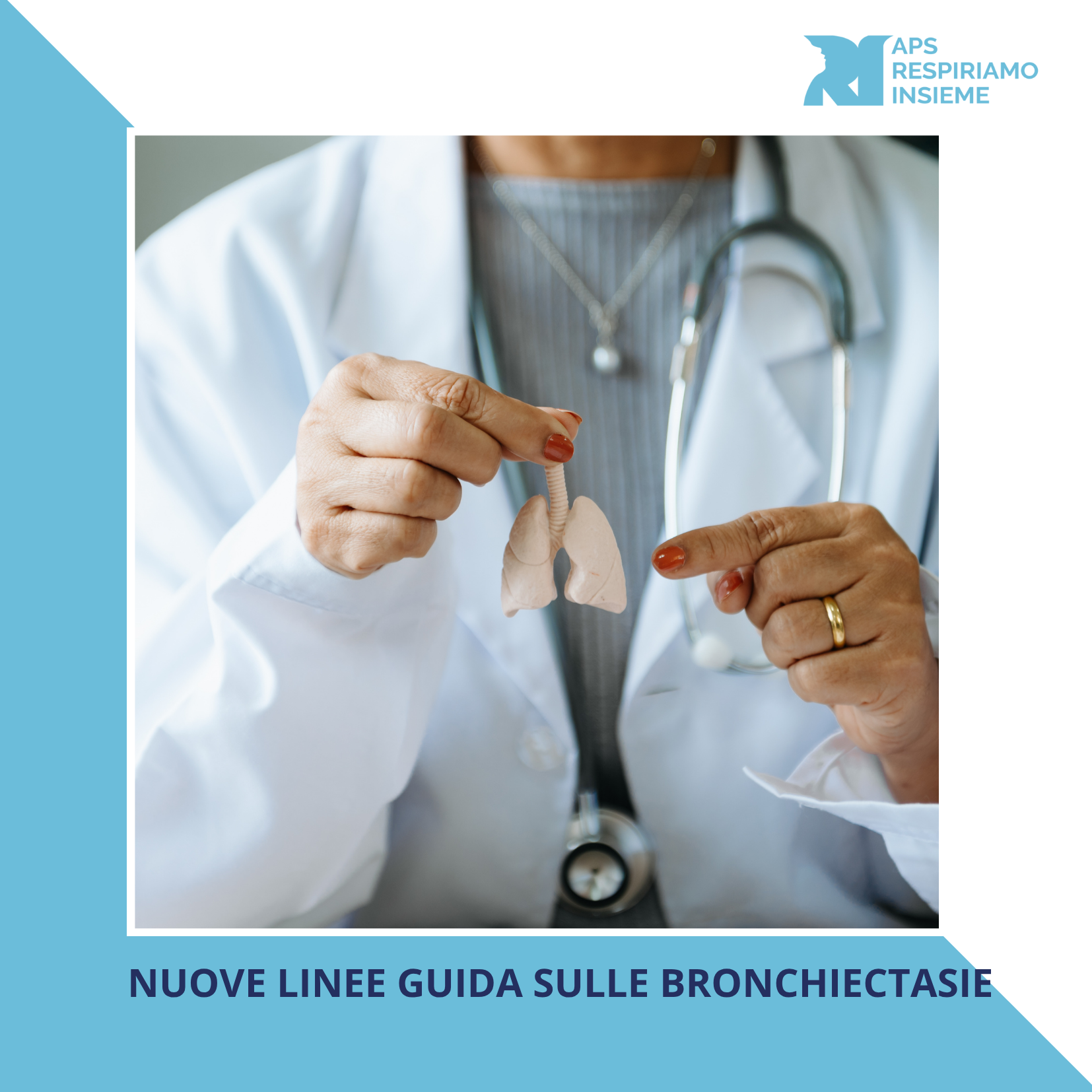Linee guida bronchiectasie