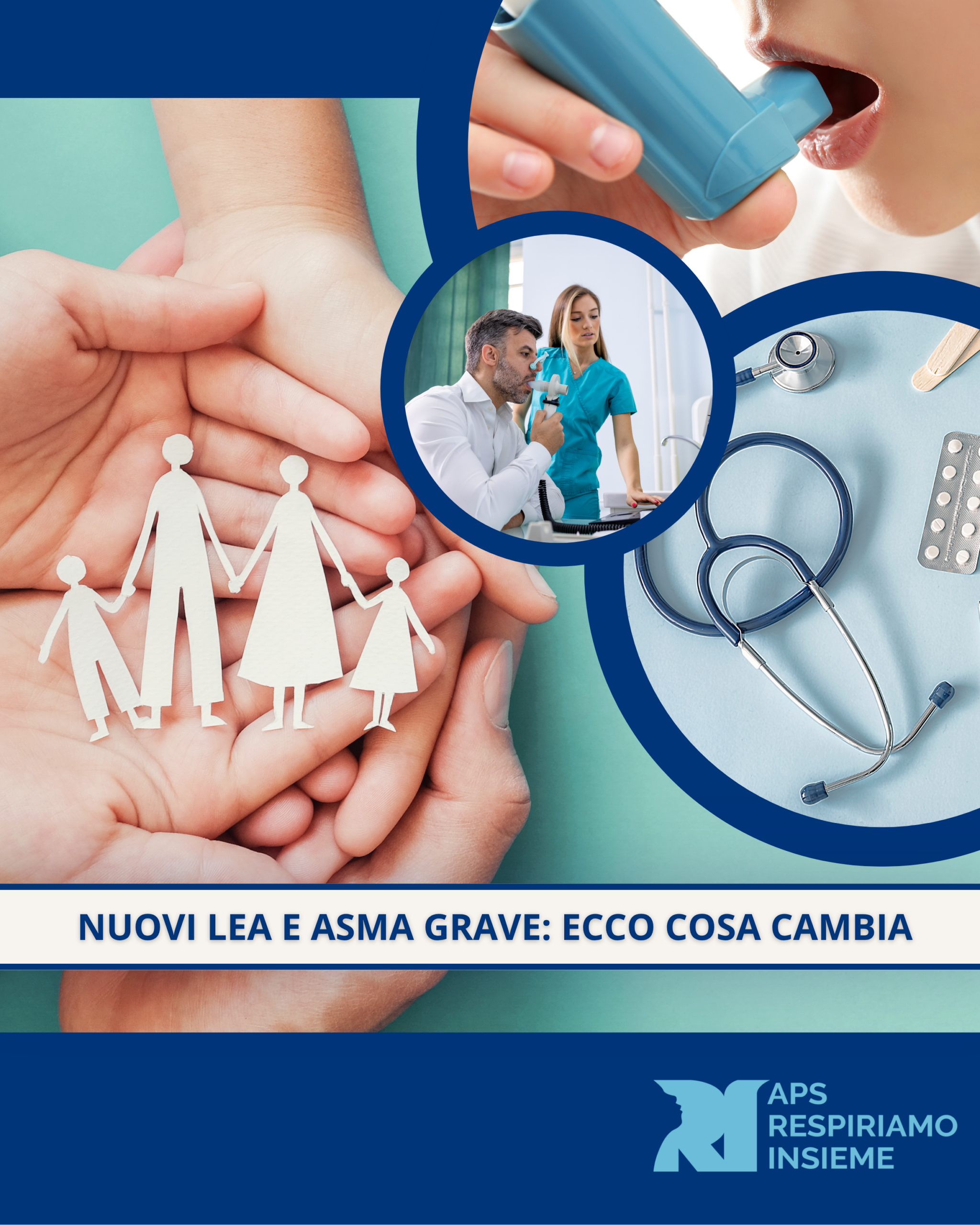 NUOVILEA E ASMA GRAVE. ECCO COSA CAMBIA
